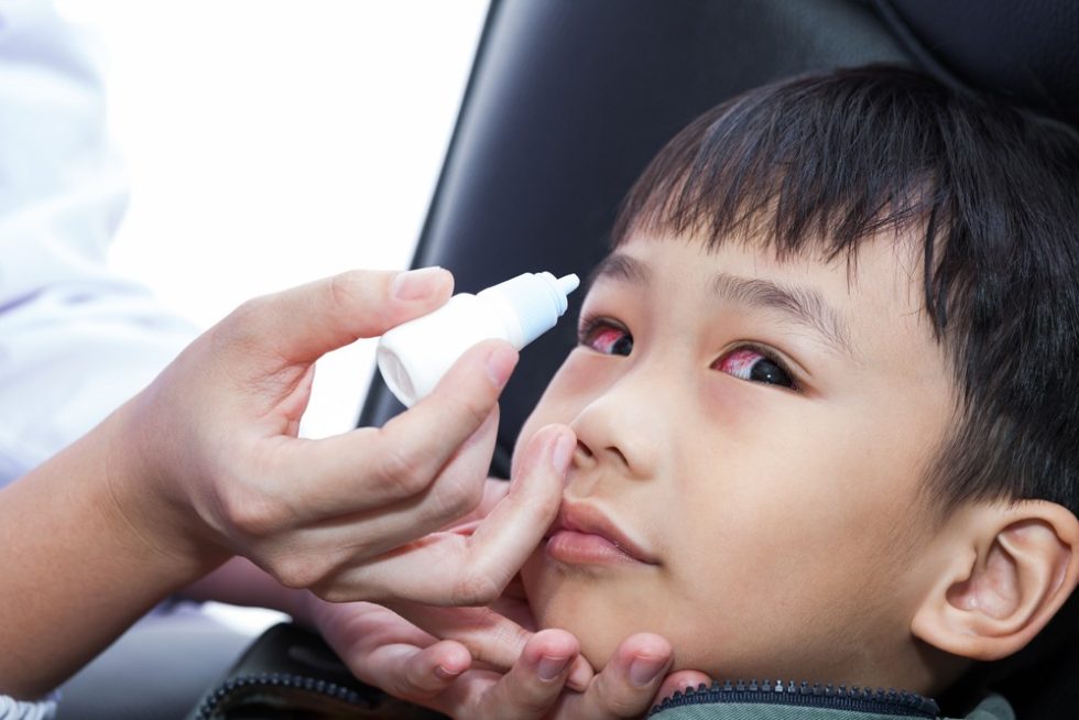 Parent putting eyedrops in childs eyes
