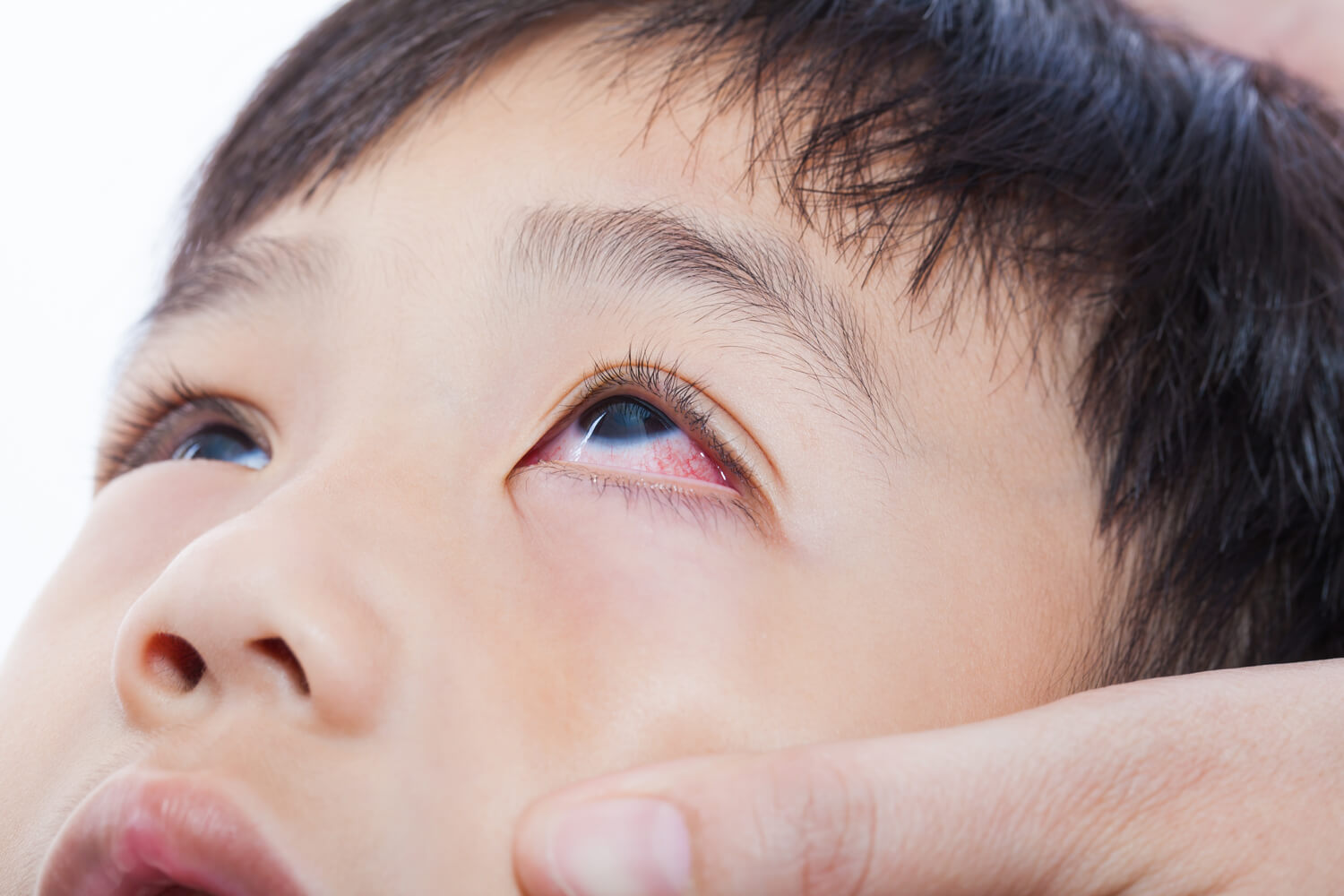 Eye Emergencies Treatment in Missouri